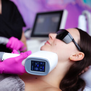 Laserowe zamykanie naczynek